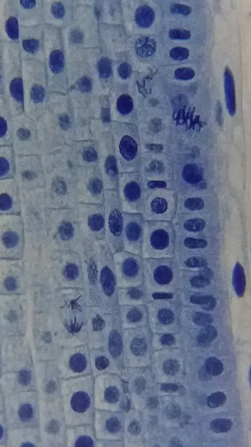 fotografía microscopio Bresser Erudit Basic 40–400x,  19