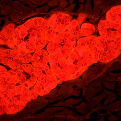 fotografía microscopio de fluorescencia MAGUS Lum 450L,  25