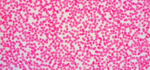 foto microscopio trinocular digital Levenhuk D670T 5.1M,  11