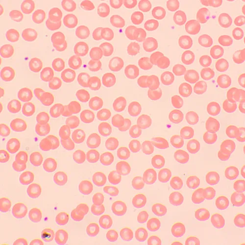 fotografía microscopio biológico MAGUS Bio 250TL,  22