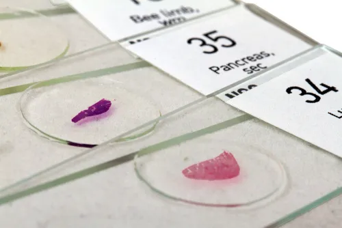 fotografía juego de preparaciones Levenhuk N80 NG «Lo verás todo»,  6