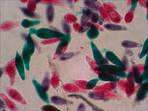 foto set de preparaciones Levenhuk N18 NG,  10