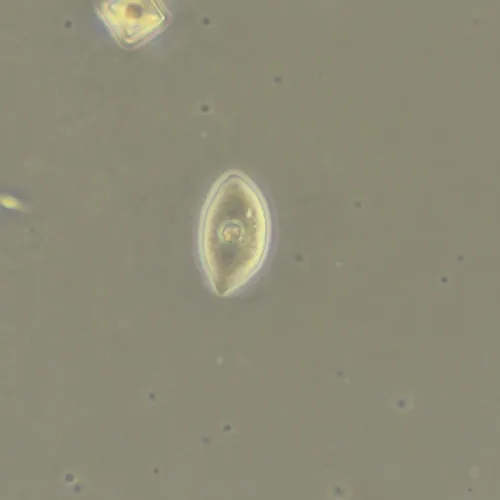 imagen dispositivo de contraste de fases MAGUS SPH360, con juego de objetivos Plan S-Apo Ph 4х/10х/20х/40х/60х H60 mm,  18