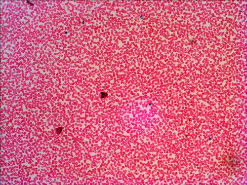 gráfico set de preparaciones Levenhuk N38 NG,  16