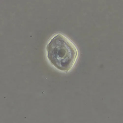 imagen dispositivo de contraste de fases MAGUS SPH360, con juego de objetivos Plan S-Apo Ph 4х/10х/20х/40х/60х H60 mm,  17