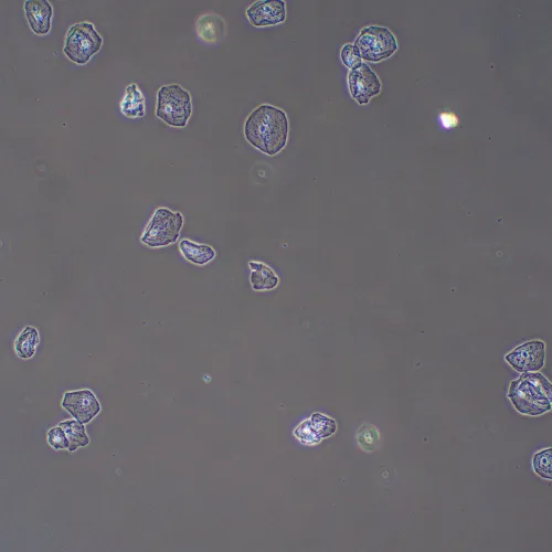 gráfico dispositivo de contraste de fases MAGUS PH2,  13