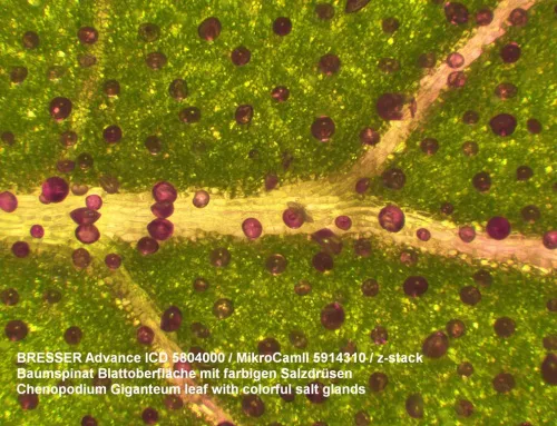 fotografía microscopio Bresser Advance ICD 10–160x,  2
