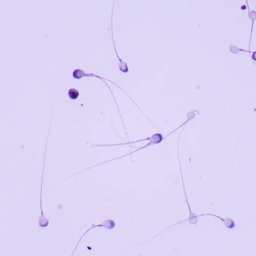 fotografía microscopio digital biológico MAGUS Bio D260T LCD,  30